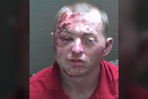 Florida man badly loses fight with police, K-9