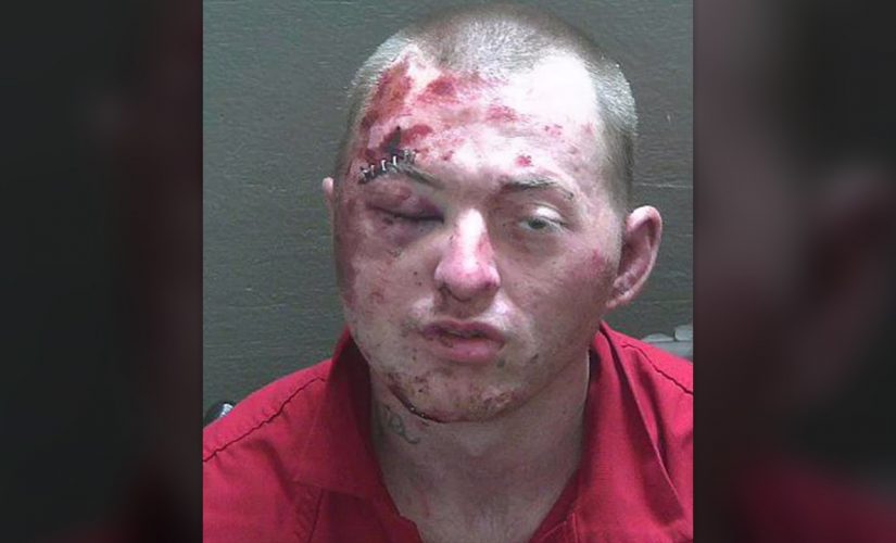 Florida man badly loses fight with police, K-9