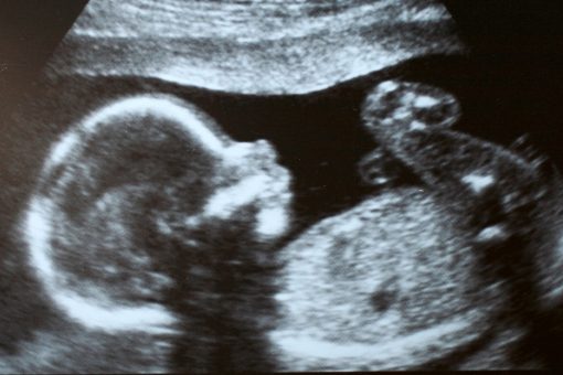 South Carolina could soon be latest state to ban abortions once a fetal heartbeat is detected