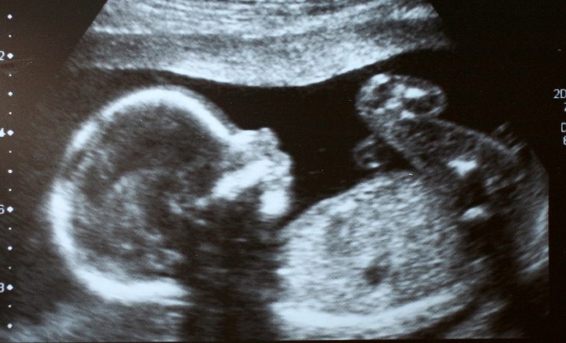 South Carolina could soon be latest state to ban abortions once a fetal heartbeat is detected