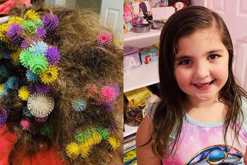Mom slams Bunchems sticky toys after 150 get stuck in daughter’s hair