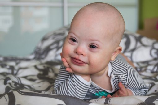 Arizona Senate panel approves Down syndrome abortion ban, other anti-abortion measures