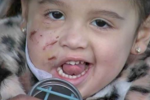 Texas dog owner charged after pet mauled 3-year-old girl at restaurant, reports say
