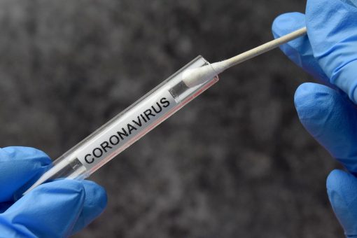 New coronavirus variants ‘not magic,’ mitigation measures will work, expert says
