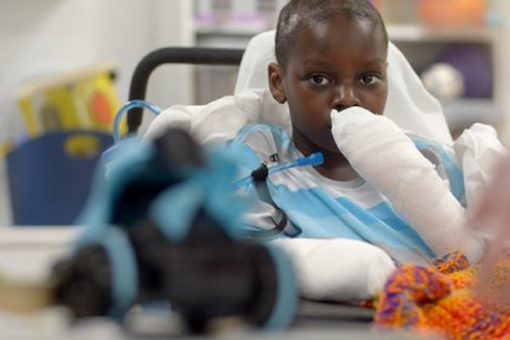 Michigan boy with rare coronavirus-related inflammatory illness endures 4 amputations