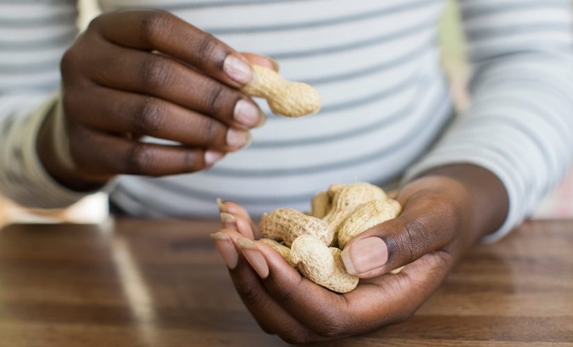 Many first report peanut allergy symptoms in adulthood, study finds