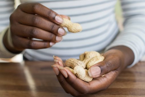 Many first report peanut allergy symptoms in adulthood, study finds