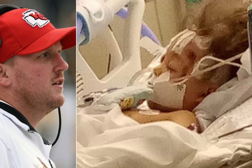 5-year-old girl seriously hurt in Ex-Chiefs coach Britt Reid crash ‘remains in a coma,’ family says