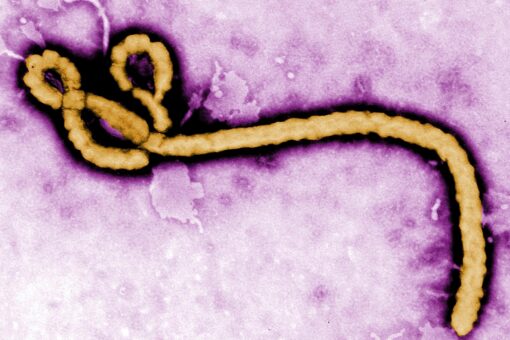 Ebola may have lingered in a survivor for 5 years before sparking new outbreak