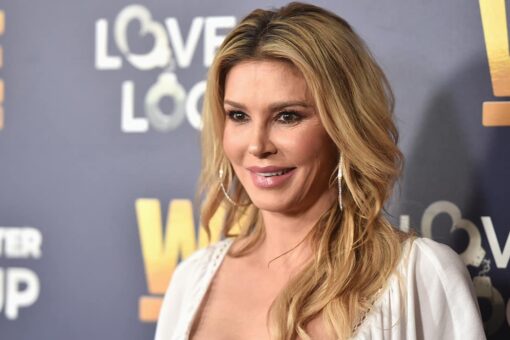 Brandi Glanville recovering from second-degree burns after psoriasis treatment mishap