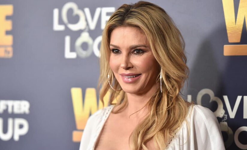 Brandi Glanville recovering from second-degree burns after psoriasis treatment mishap