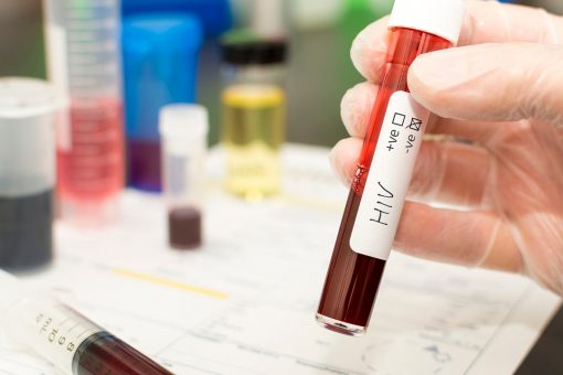 Scientists find ‘HIV elite controllers’ living in Congo, possibly paving way for vaccine, cure