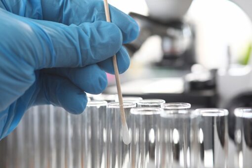 FDA approves new COVID-19 test that could help ‘long haulers’