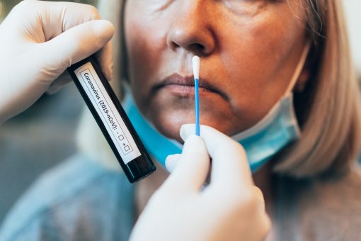 Plunging demand for COVID-19 tests may leave US exposed