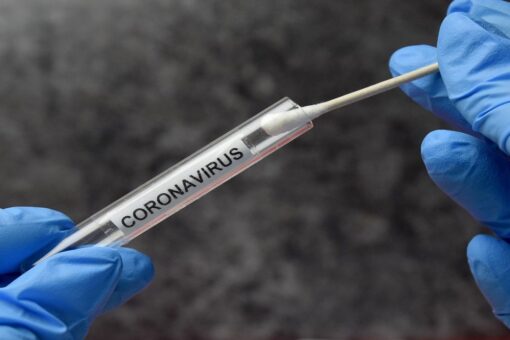 US tops 30M coronavirus infections, JHU data shows
