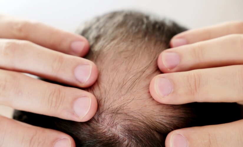 Why can chronic stress result in hair loss? New research provides clues