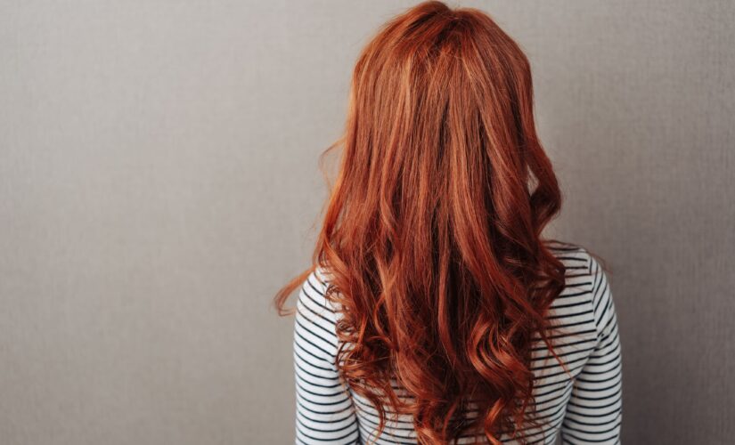 Why redheads feel less pain, according to scientists