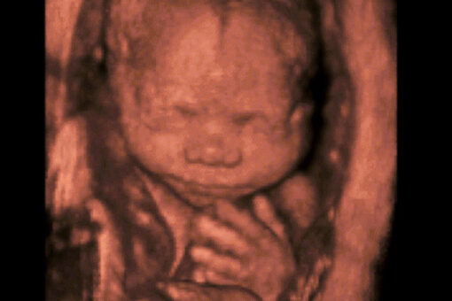Group launches $2M TV campaign to highlight the humanity of unborn children