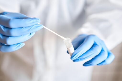 Roche’s COVID-19 test for asymptomatic people gets greenlight