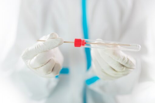 Scientists find new human coronavirus that originated in dogs: report