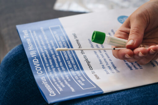 Do vaccinated people need COVID-19 tests?