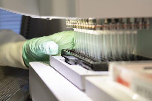 FDA approval of Biogen’s Alzheimer’s drug leaves some ‘disappointed’