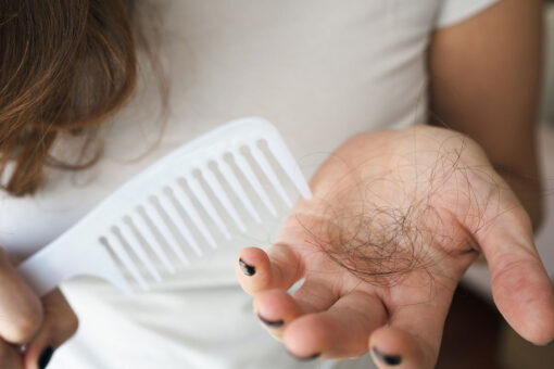 These treatments can help COVID-19-related hair loss, doctors say