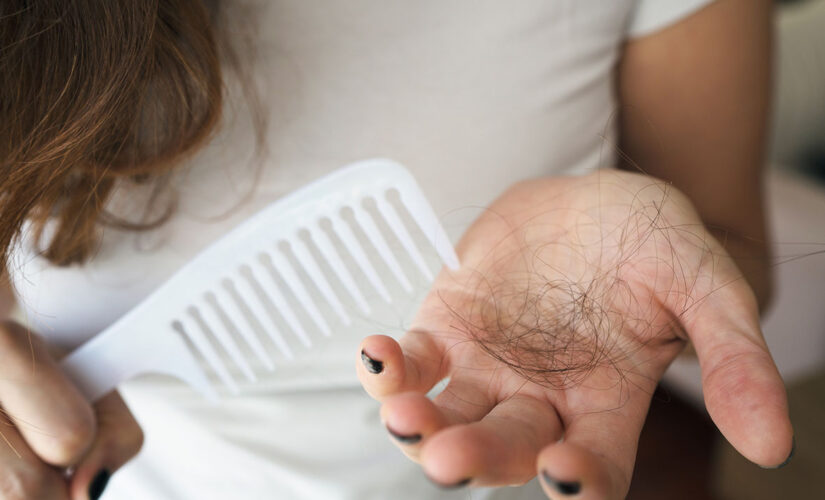 These treatments can help COVID-19-related hair loss, doctors say