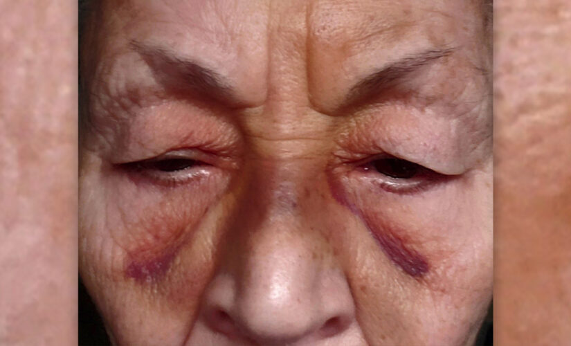 Wisconsin Walmart employee facing charges after repeatedly punching elderly woman, police
