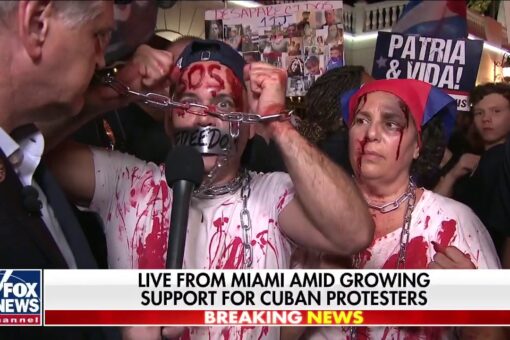 ‘Bloodied’ Little Havana demonstrator slams Biden: ‘Cubans don’t want vaccines, they want freedom’