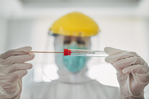 Delta most common COVID-19 variant in US, data show