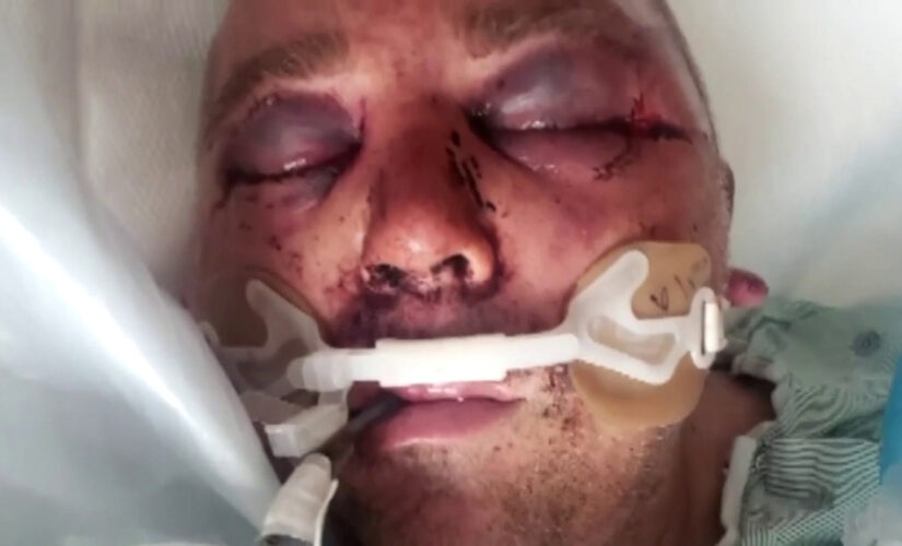 Florida man brutally beaten, put in a coma after asking neighbors to lower music