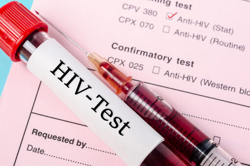 Florida man who hid HIV status from lovers sentenced to prison