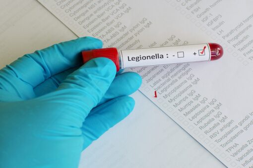 Michigan reports uptick in Legionnaires’ disease