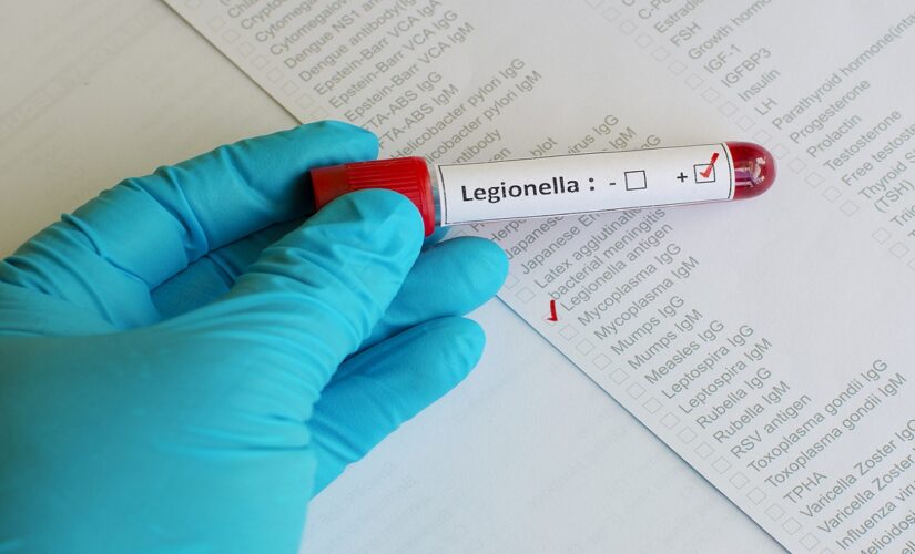 Michigan reports uptick in Legionnaires’ disease