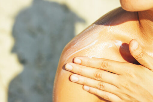 How to treat a sunburn: Signs to watch for this summer