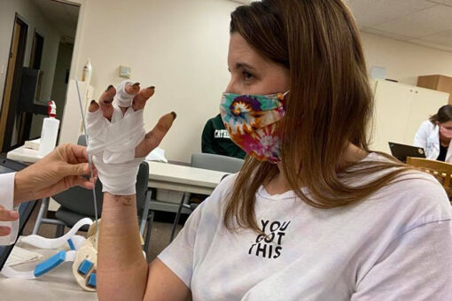 Mom warns against fireworks after one explodes and ‘blew’ her hand in half