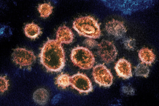West Virginia offers first statewide antibody testing for fully vaccinated