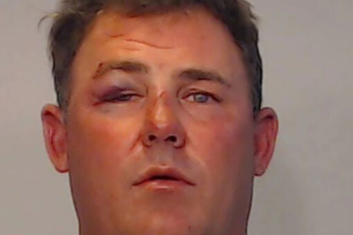 Florida man bit off part of friend’s ear during Key West hotel brawl, authorities say