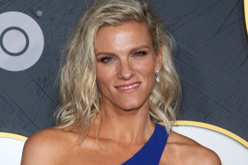 Ben Affleck’s ex-girlfriend Lindsay Shookus proudly reveals birthmark covering her entire leg