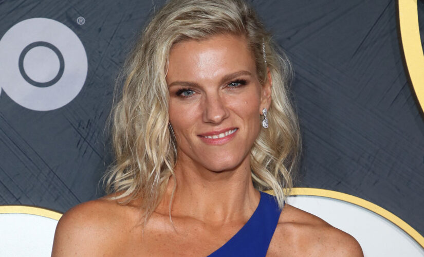 Ben Affleck’s ex-girlfriend Lindsay Shookus proudly reveals birthmark covering her entire leg