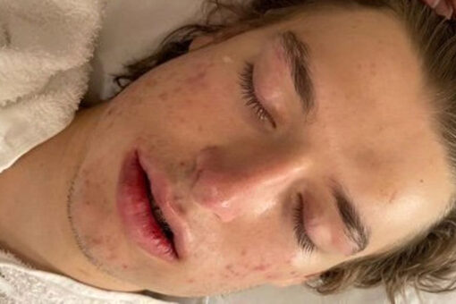 Teen brutally beaten in ‘unprovoked’ attack while students record and laugh