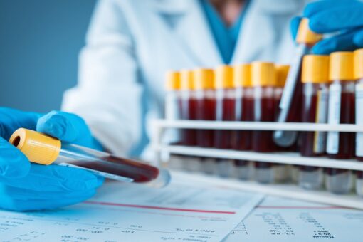 Scientists look to blood tests to spot dementia risk early on