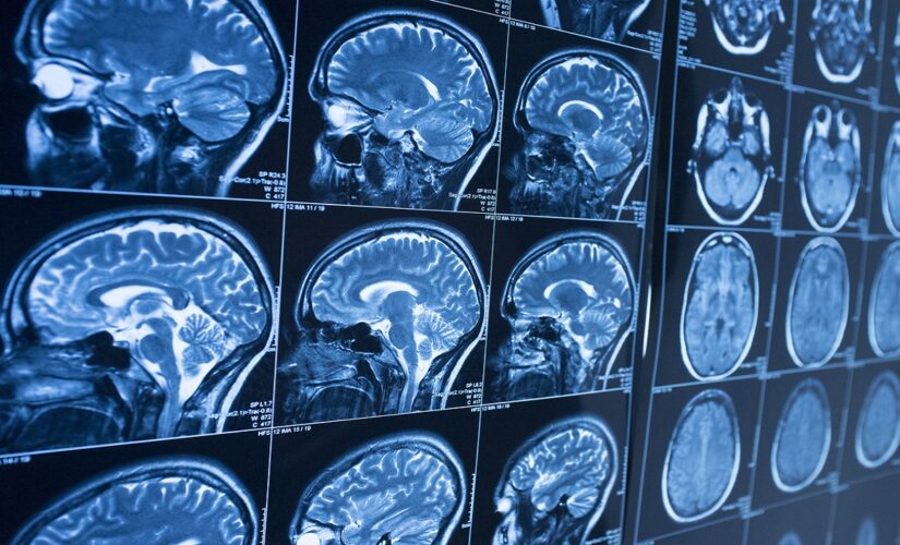 Babies born during COVID-19 pandemic tied with lower IQ, study suggests