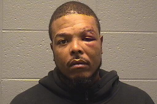Man beats off-duty Chicago police officer, bites off friend’s nipple in road rage incident: report
