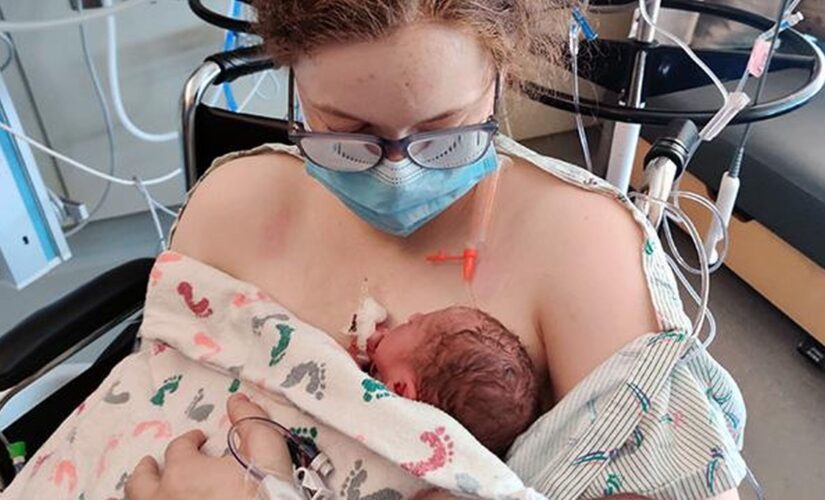 Formerly conjoined twin gives birth at hospital where she was born