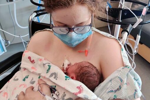 Formerly conjoined twin gives birth at hospital where she was born