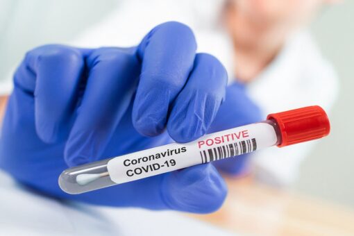 San Francisco hospitals report hundreds of COVID-19 infections among vaccinated staff