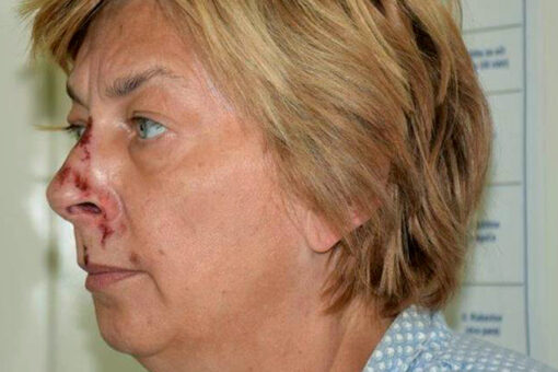Amnesiac woman found bloodied and with no ID in Croatia was once a Hollywood jewelry designer