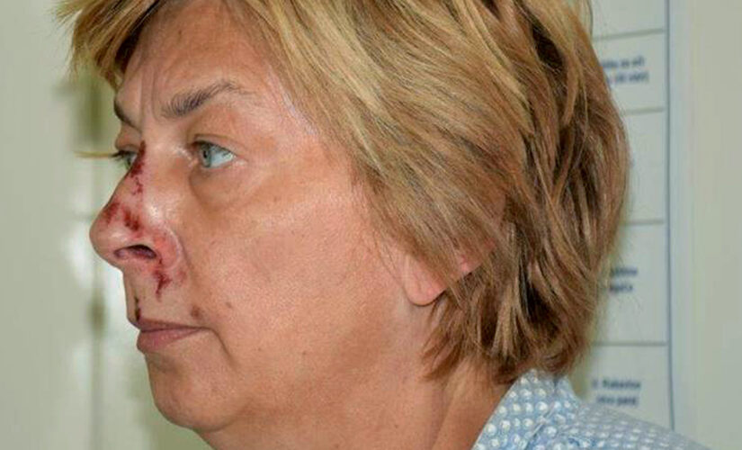 Amnesiac woman found bloodied and with no ID in Croatia was once a Hollywood jewelry designer